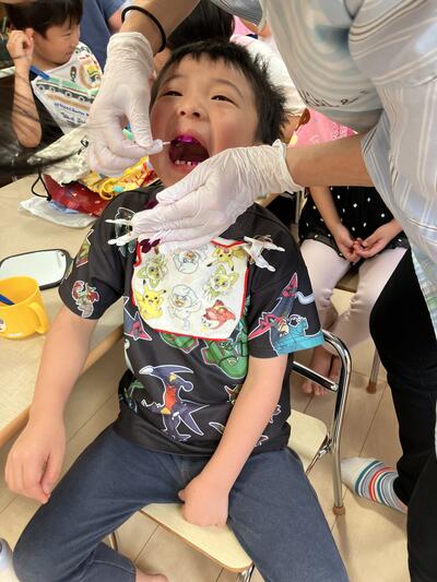 25.9.19歯科衛生染め出し.jpg